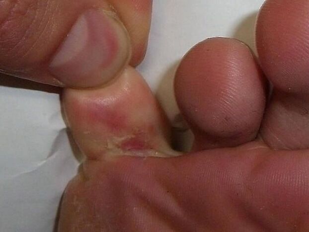 The effect of the mushroom on the skin