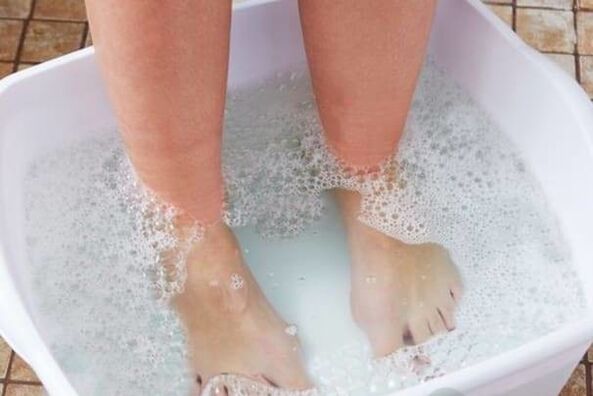 Treatment of the nail fungus with popular remedies