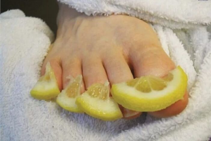 Compresses of lemon drops - a folk remedy against toenail fungus